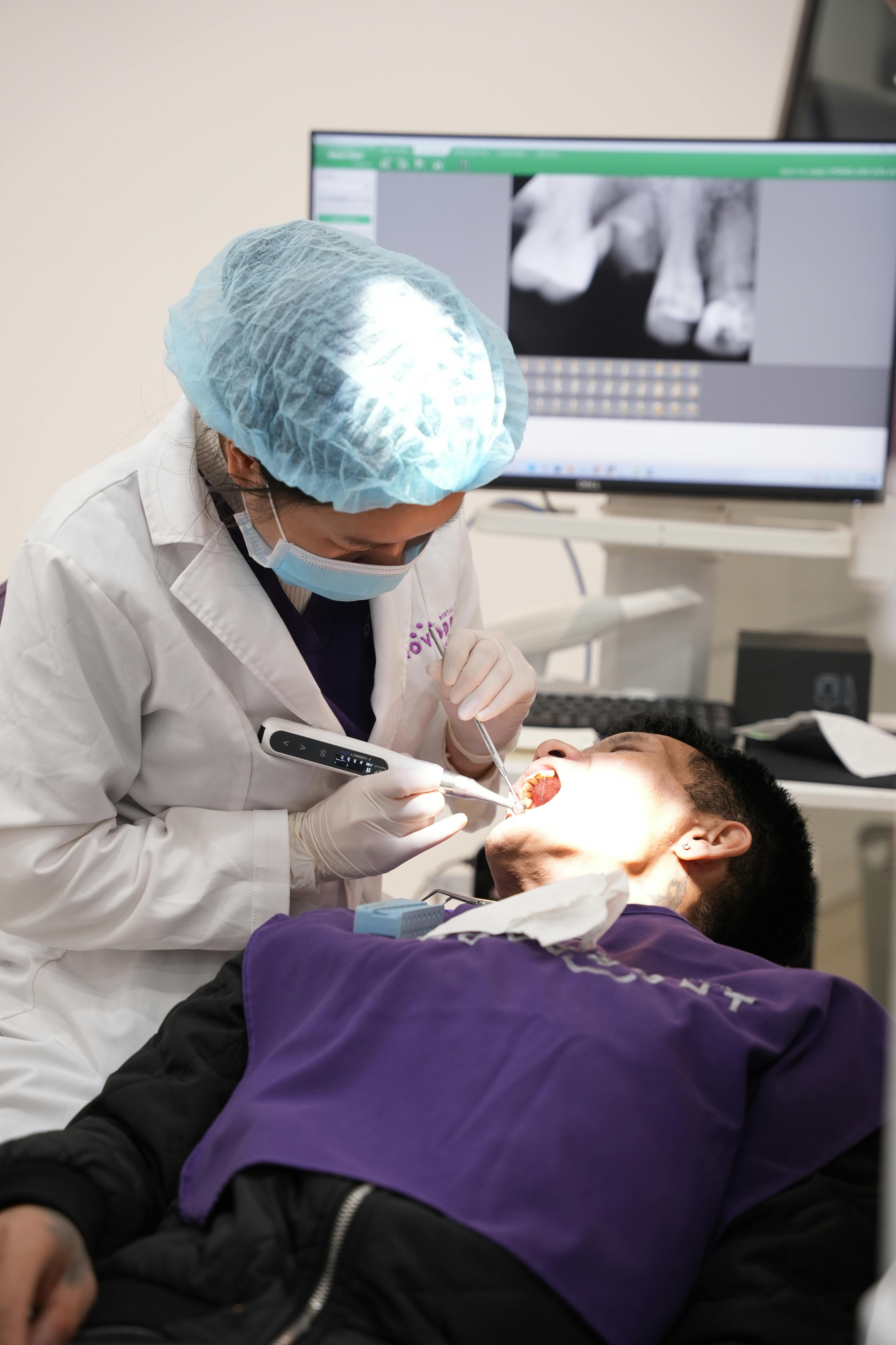 Root Canal FAQ