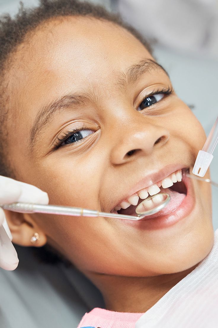 Pediatric Dentistry FAQ
